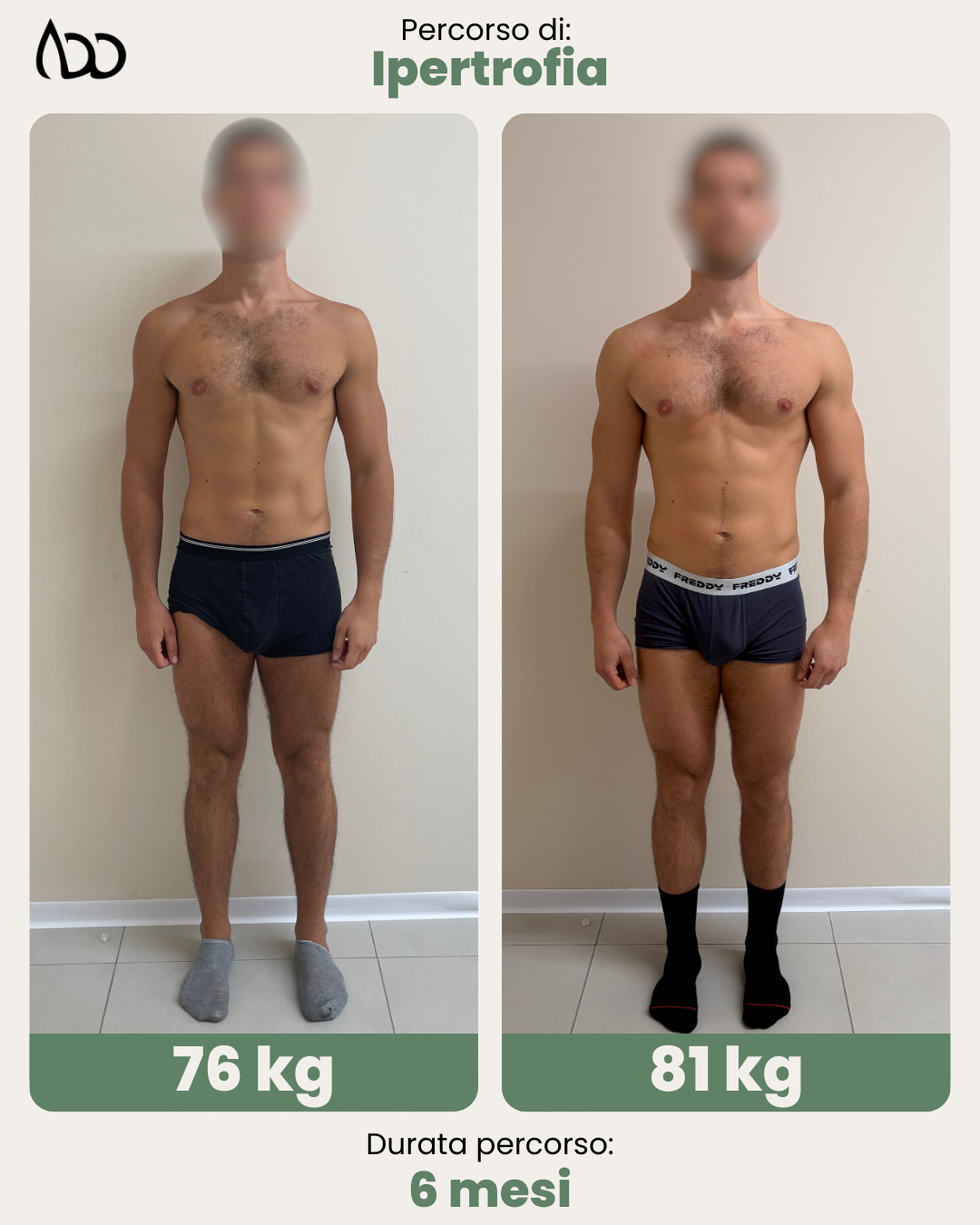 Caso studio: Ipertrofia, 6 mesi