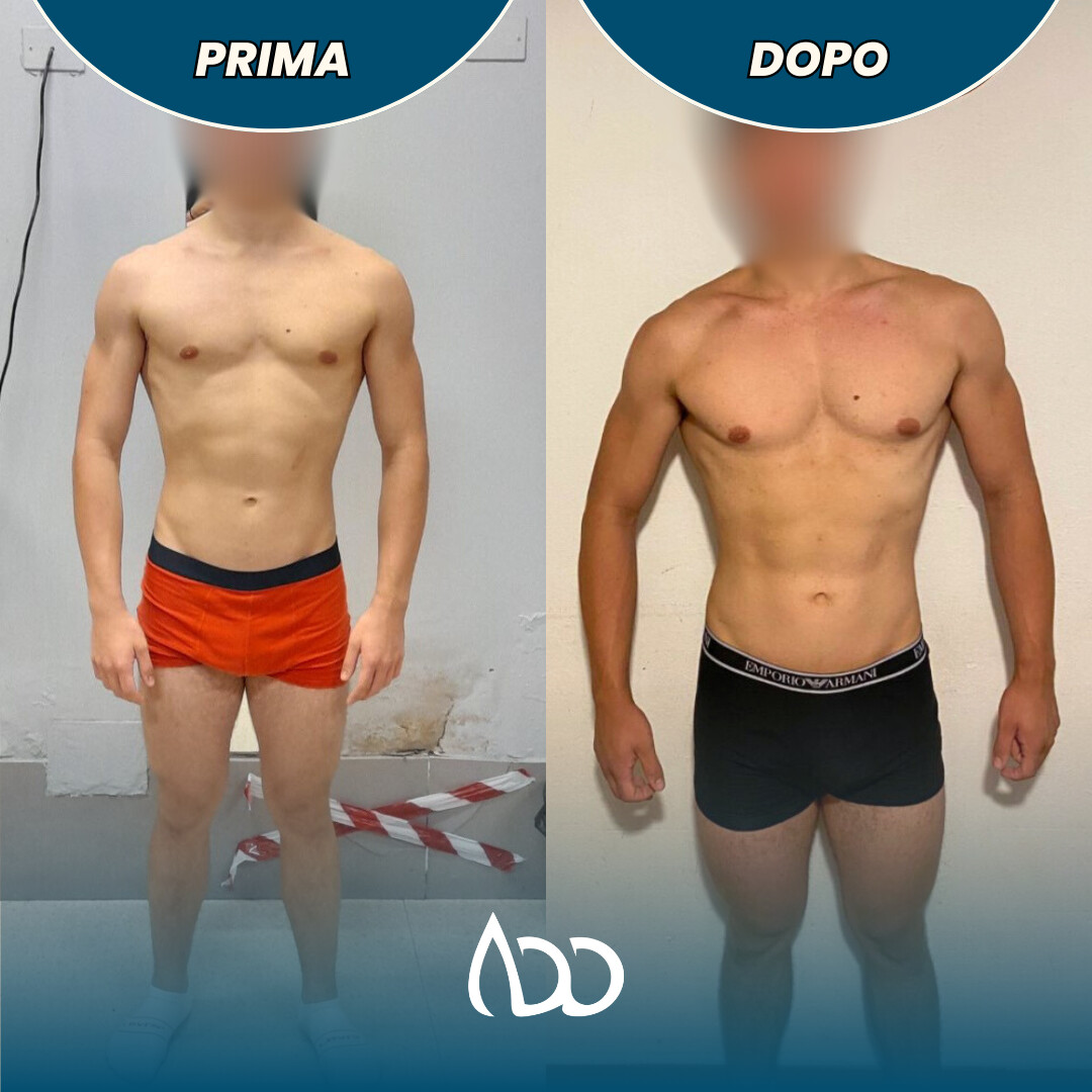 Caso studio: prima e dopo