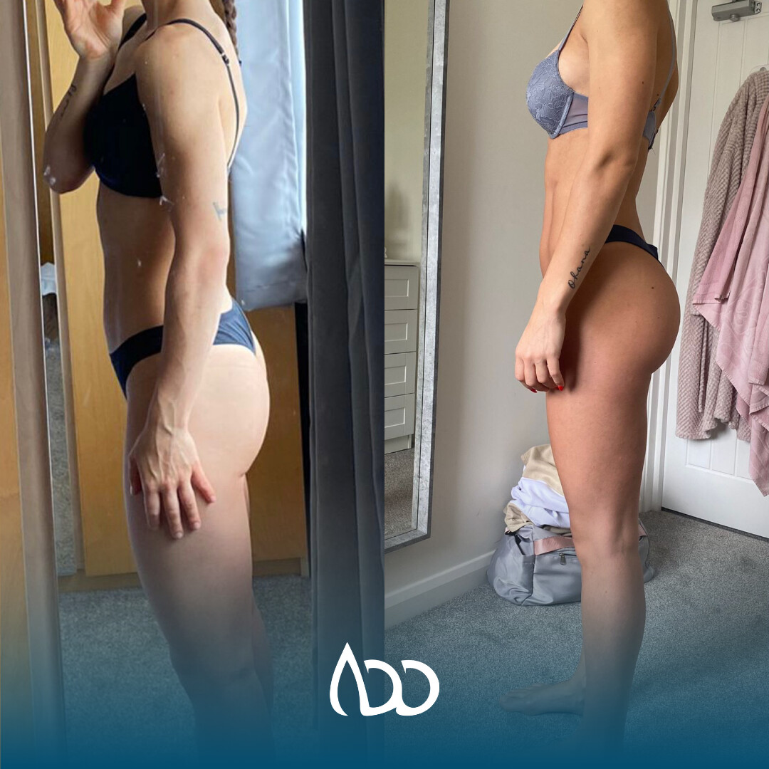 Caso studio: prima e dopo