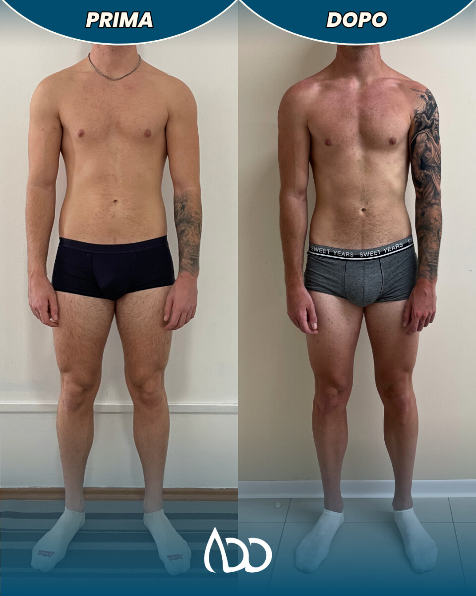 Caso studio: definizione